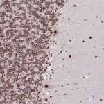 Atlas Antibodies Anti-TDG Antibody