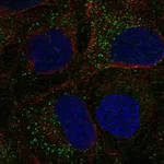 Atlas Antibodies Anti-TDGF1 Antibody