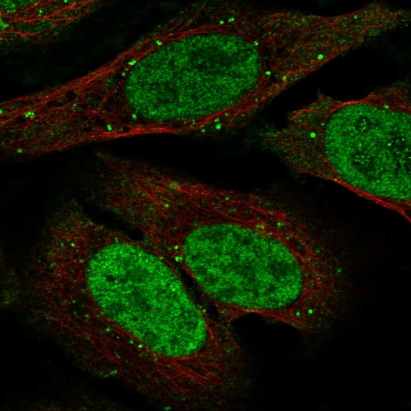 Atlas Antibodies Anti-TDP1 Antibody