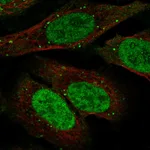 Atlas Antibodies Anti-TDP1 Antibody