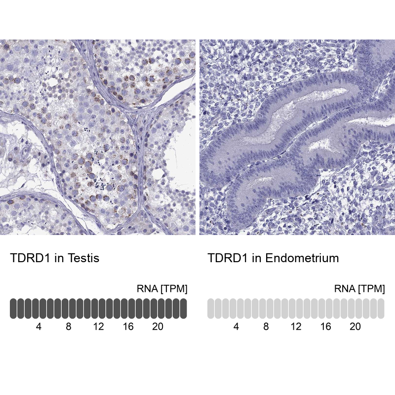 Atlas Antibodies Anti-TDRD1 Antibody