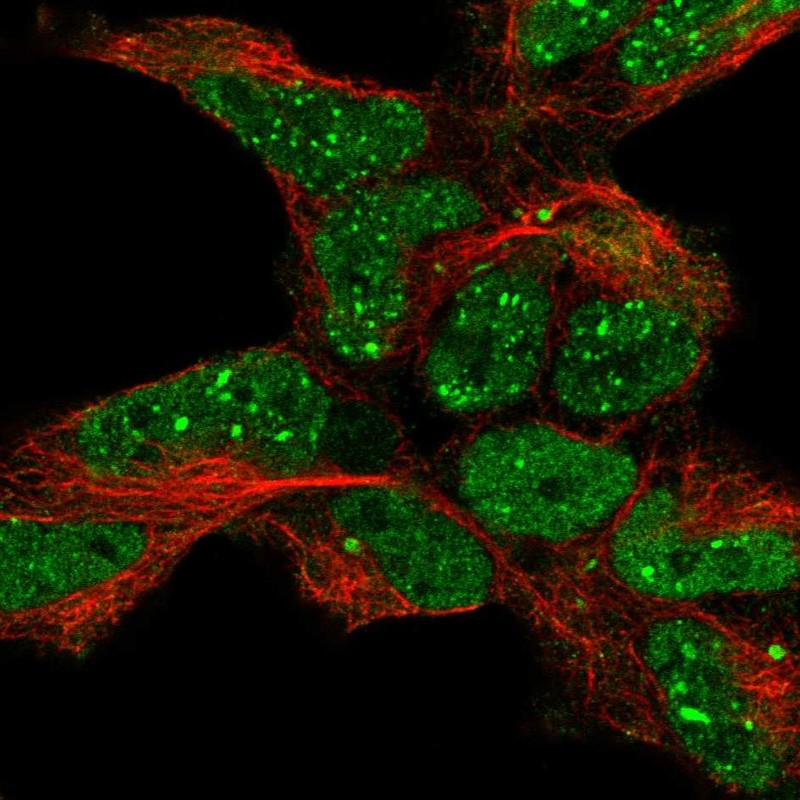 Atlas Antibodies Anti-TDP2 Antibody
