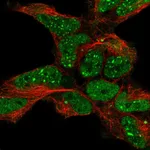 Atlas Antibodies Anti-TDP2 Antibody