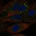 Atlas Antibodies Anti-TDRD10 Antibody