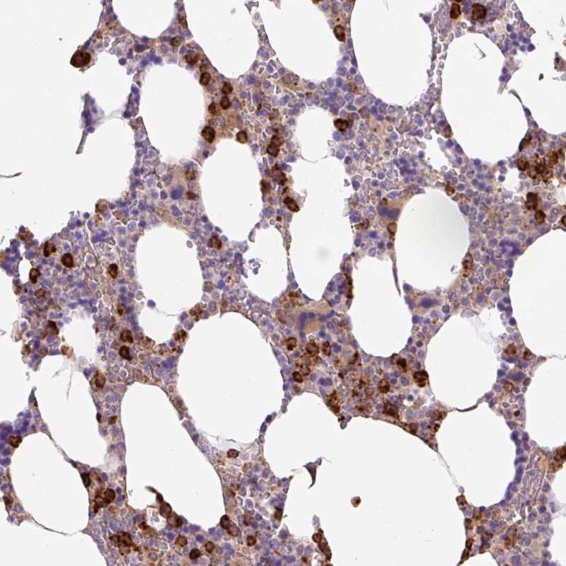 Atlas Antibodies Anti-TDRD15 Antibody