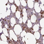 Atlas Antibodies Anti-TDRD15 Antibody