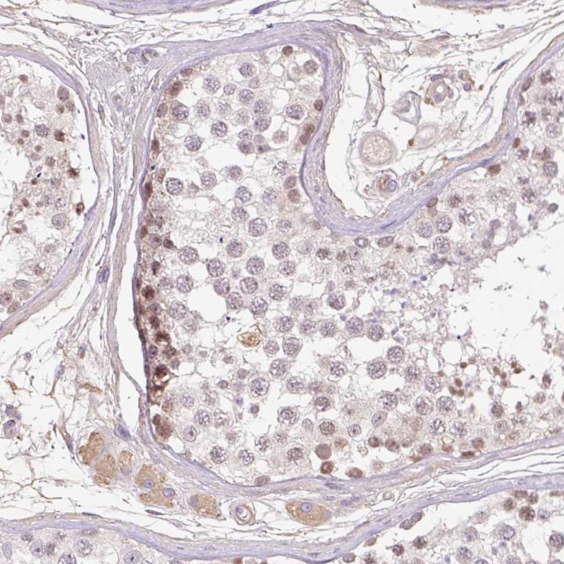 Atlas Antibodies Anti-TDRD15 Antibody