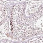 Atlas Antibodies Anti-TDRD15 Antibody