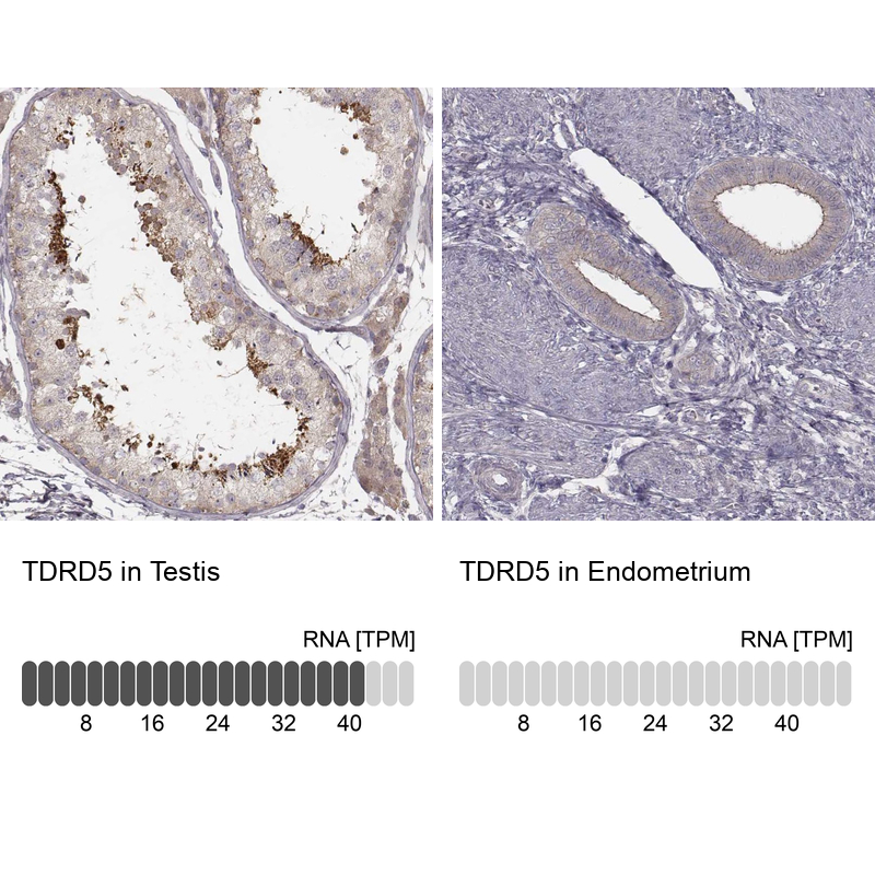 Atlas Antibodies Anti-TDRD5 Antibody