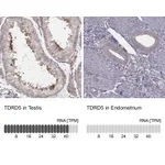 Atlas Antibodies Anti-TDRD5 Antibody