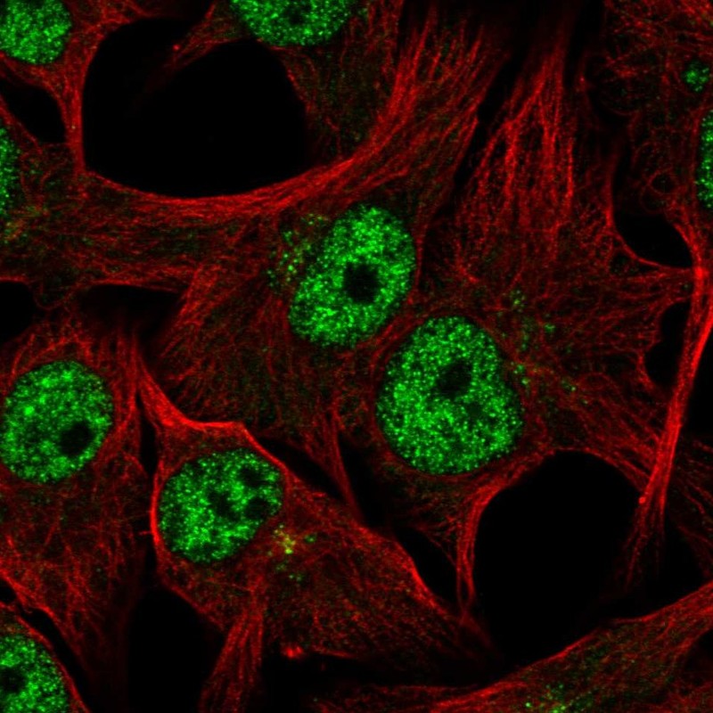 Atlas Antibodies Anti-TDRD3 Antibody