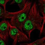 Atlas Antibodies Anti-TDRD3 Antibody