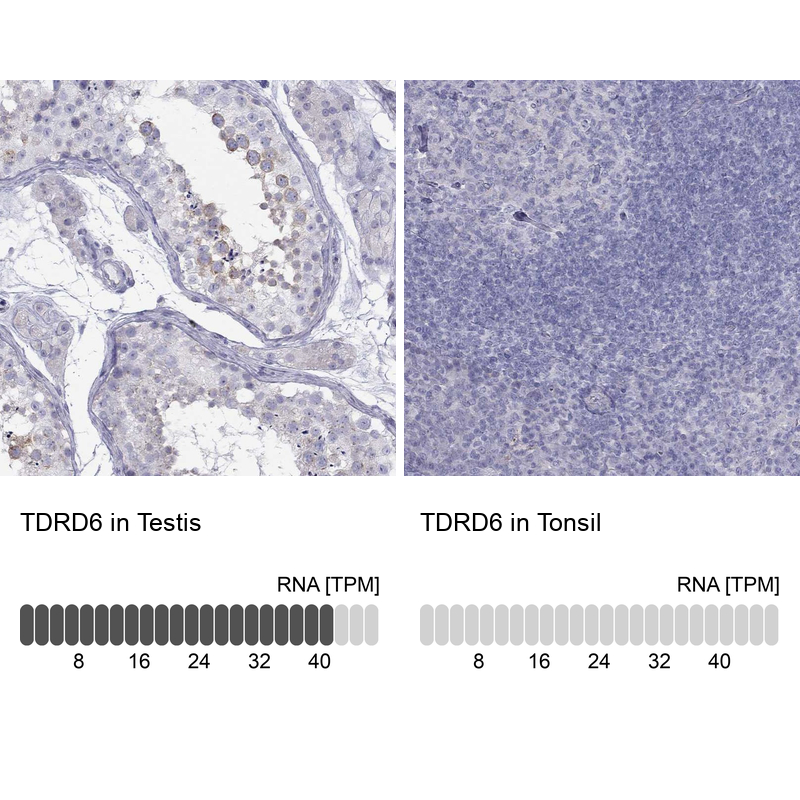 Atlas Antibodies Anti-TDRD6 Antibody