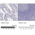 Atlas Antibodies Anti-TDRD6 Antibody
