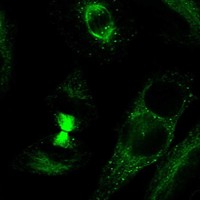 Atlas Antibodies Anti-TDRD6 Antibody