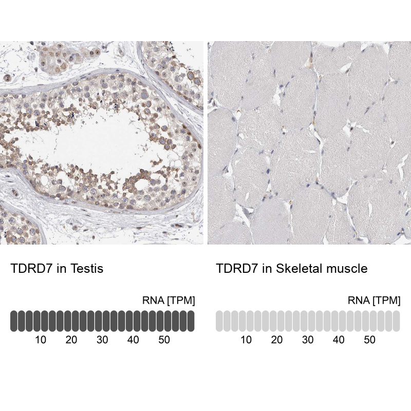 Atlas Antibodies Anti-TDRD7 Antibody