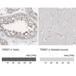 Atlas Antibodies Anti-TDRD7 Antibody