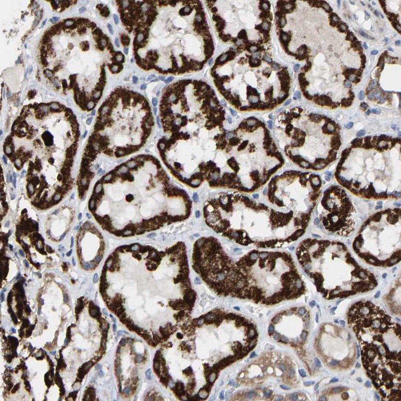 Atlas Antibodies Anti-TDRKH Antibody