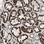 Atlas Antibodies Anti-TDRKH Antibody