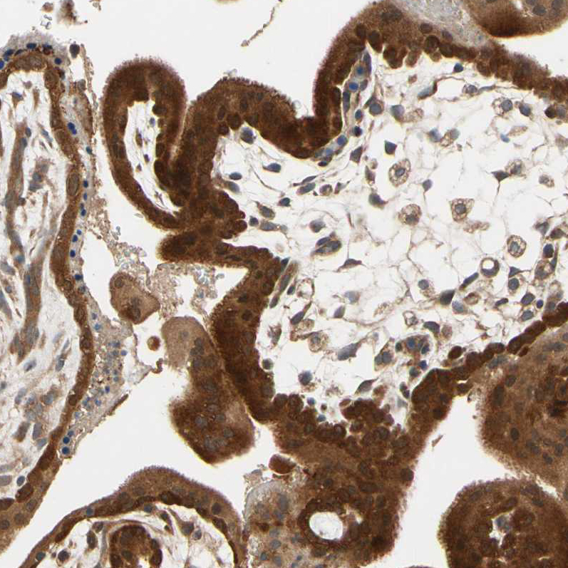 Atlas Antibodies Anti-TDRP Antibody