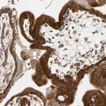 Atlas Antibodies Anti-TDRP Antibody