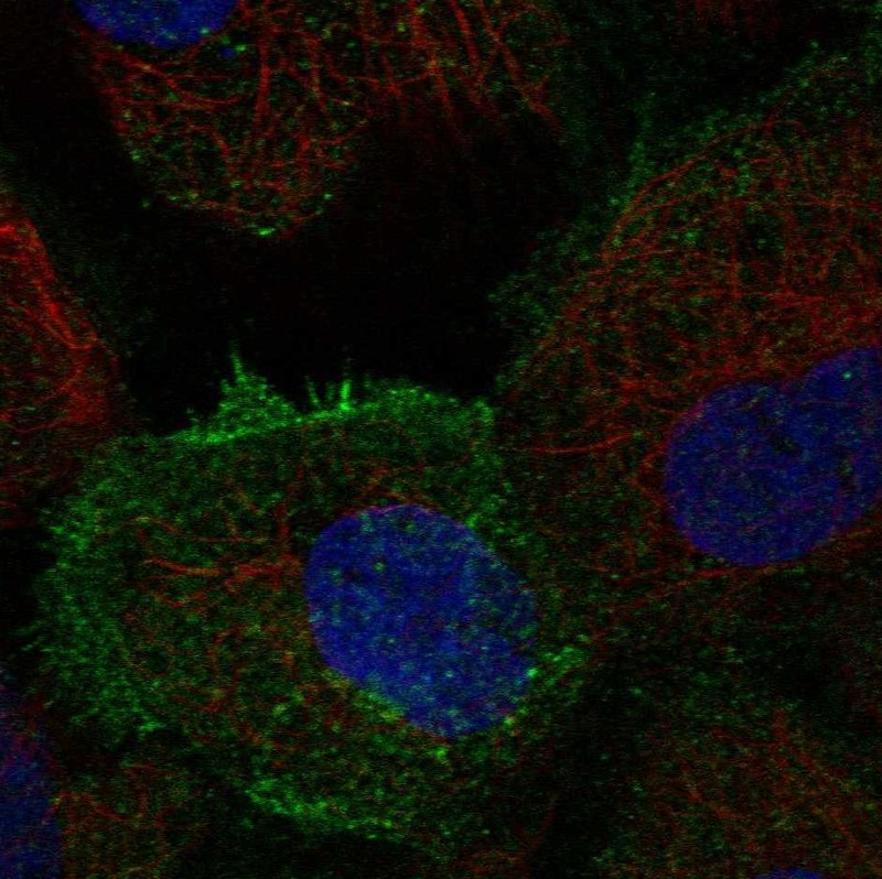 Atlas Antibodies Anti-TEC Antibody