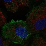 Atlas Antibodies Anti-TEC Antibody
