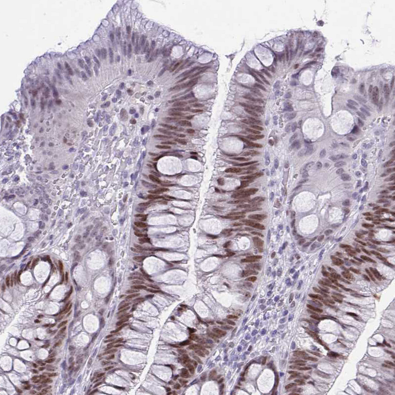 Atlas Antibodies Anti-TEAD4 Antibody