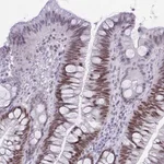 Atlas Antibodies Anti-TEAD4 Antibody
