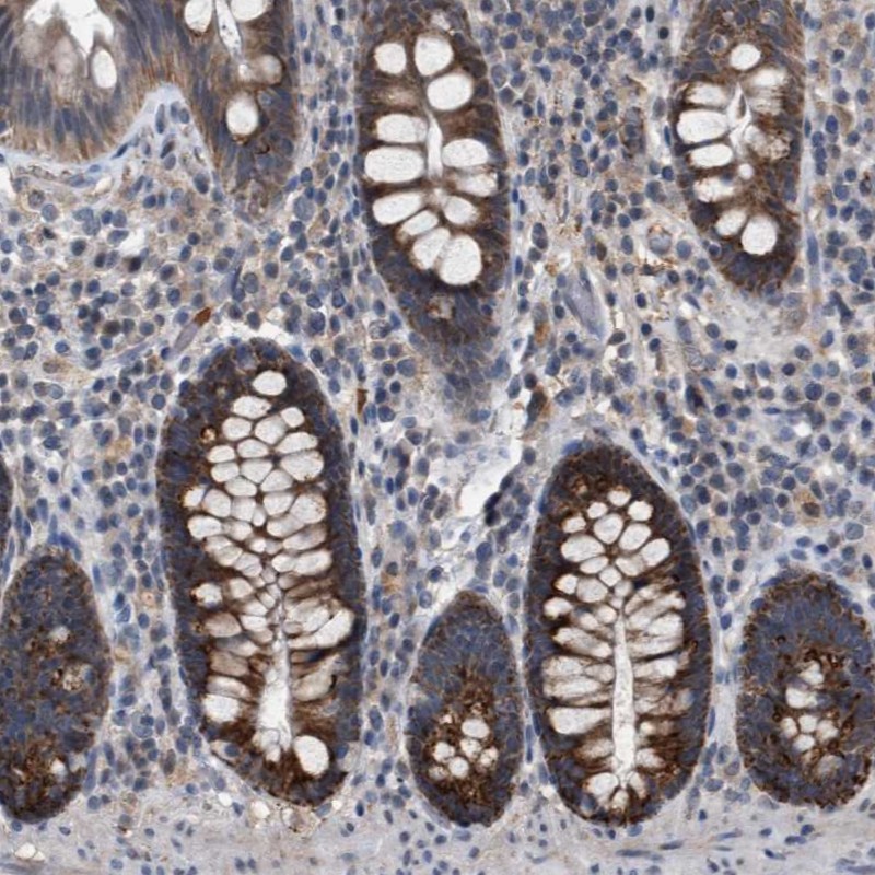 Atlas Antibodies Anti-TECPR1 Antibody