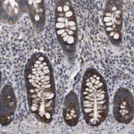 Atlas Antibodies Anti-TECPR1 Antibody
