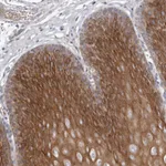 Atlas Antibodies Anti-TECR Antibody
