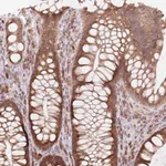Atlas Antibodies Anti-TECR Antibody