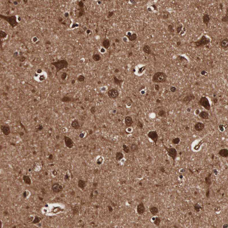 Atlas Antibodies Anti-TECPR2 Antibody