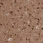 Atlas Antibodies Anti-TECPR2 Antibody