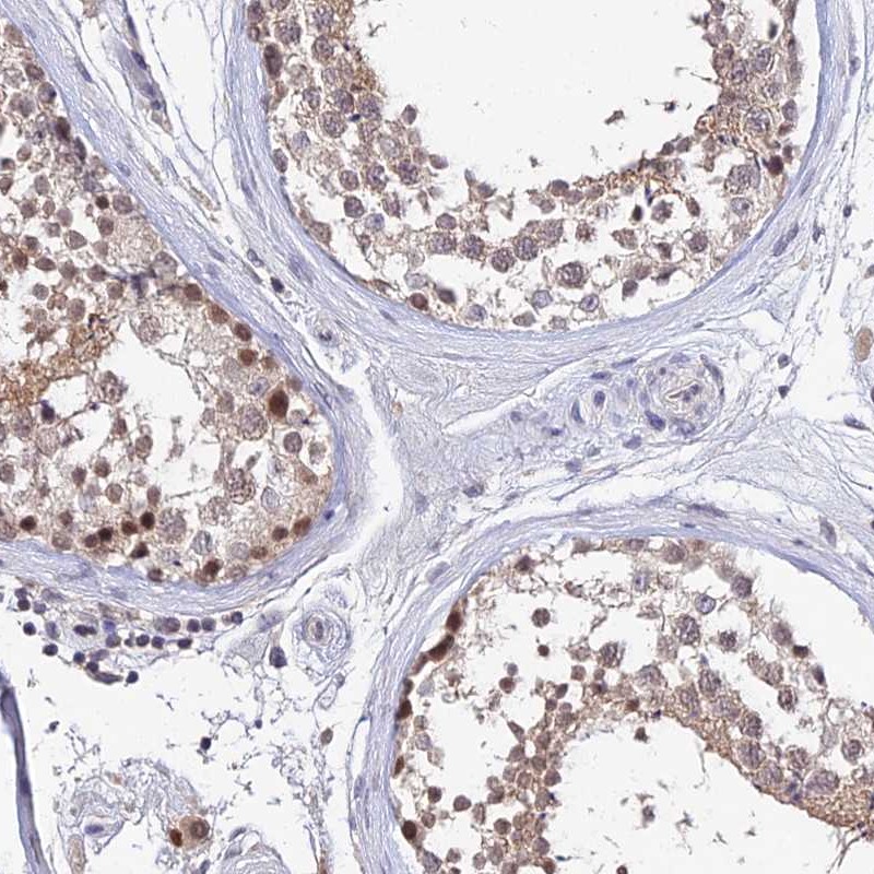 Atlas Antibodies Anti-TEKT1 Antibody
