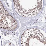 Atlas Antibodies Anti-TEKT1 Antibody