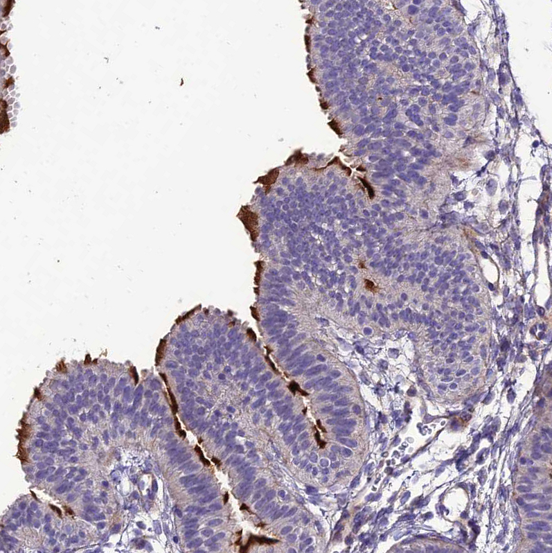 Atlas Antibodies Anti-TEKT3 Antibody