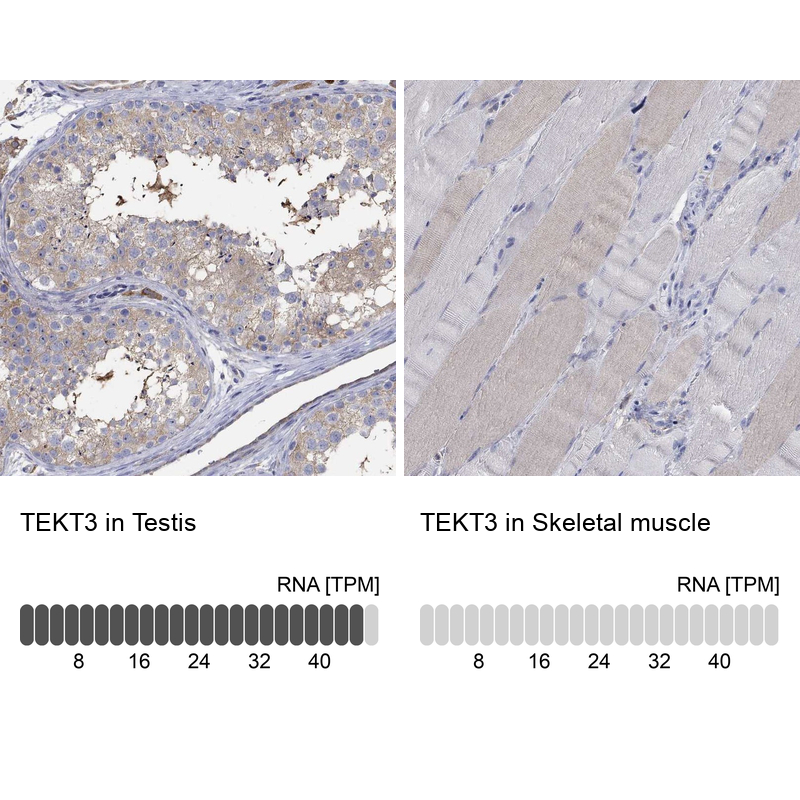 Atlas Antibodies Anti-TEKT3 Antibody