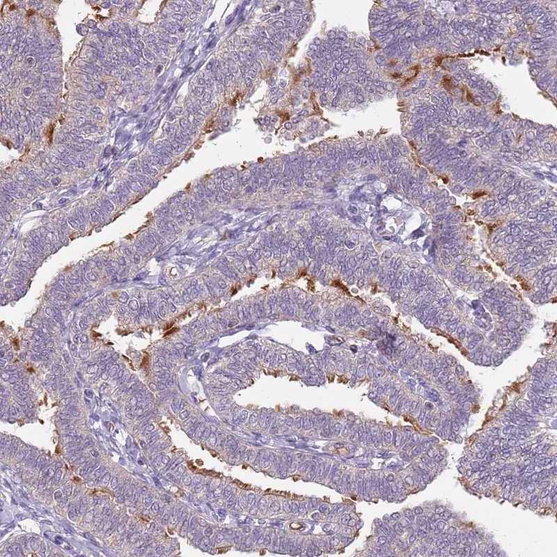 Atlas Antibodies Anti-TEKT4 Antibody