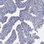 Atlas Antibodies Anti-TEKT4 Antibody