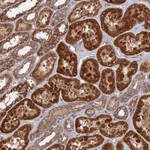 Atlas Antibodies Anti-TELO2 Antibody