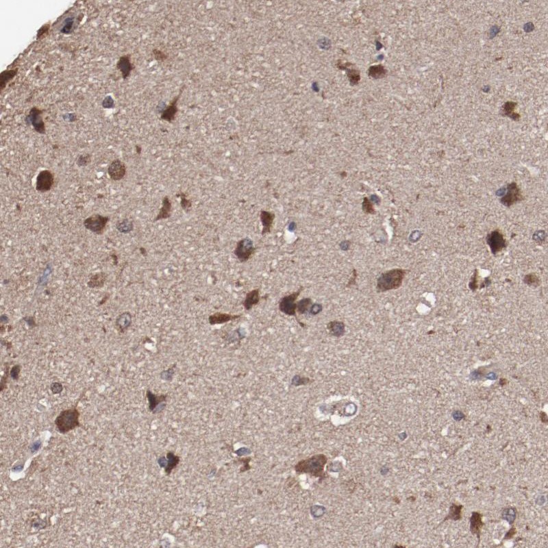 Atlas Antibodies Anti-TENM1 Antibody