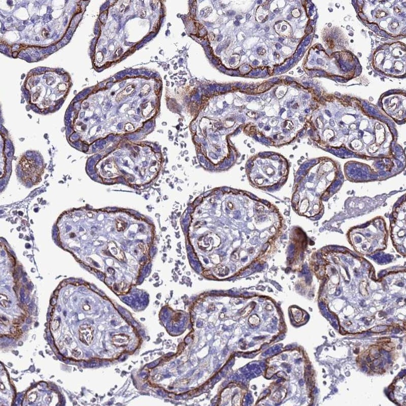 Atlas Antibodies Anti-TENM3 Antibody