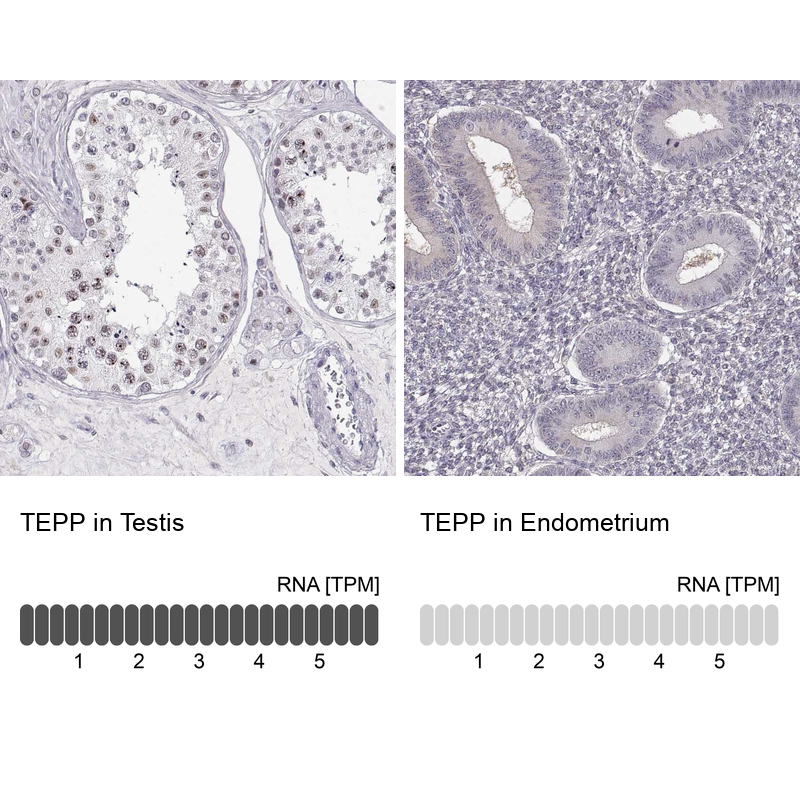 Atlas Antibodies Anti-TEPP Antibody