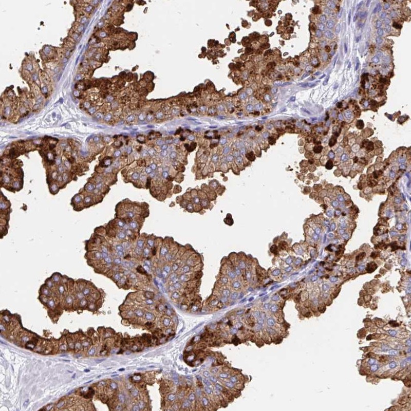 Atlas Antibodies Anti-TEKT4 Antibody