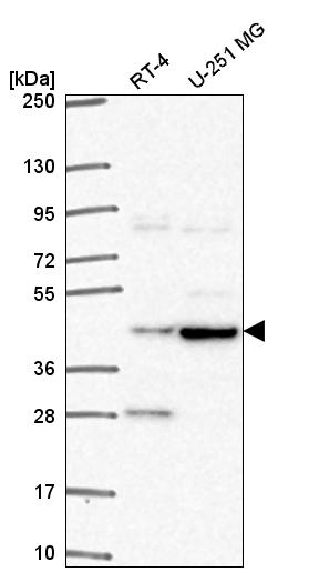 Atlas Antibodies Anti-TEPSIN Antibody