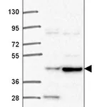 Atlas Antibodies Anti-TEPSIN Antibody