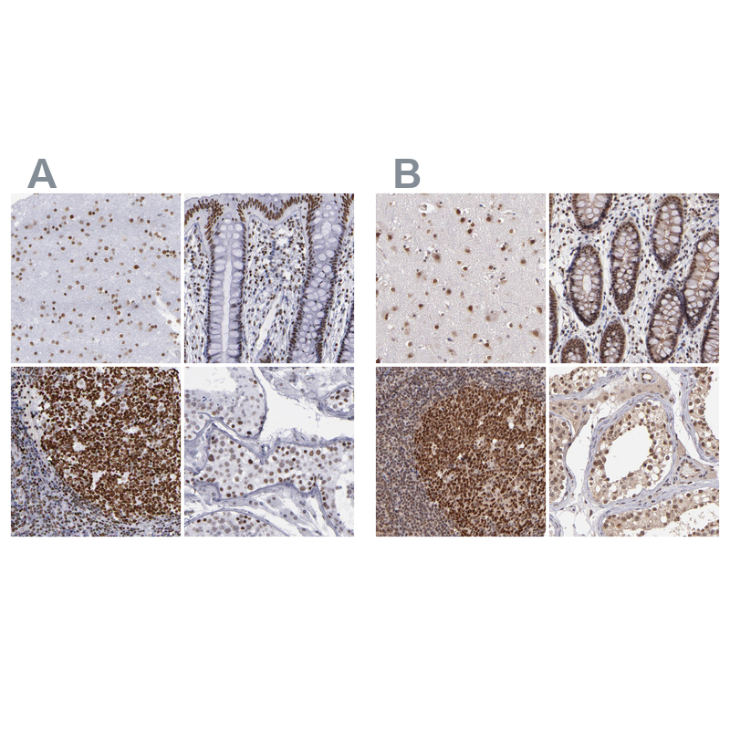 Atlas Antibodies Anti-TERF2 Antibody