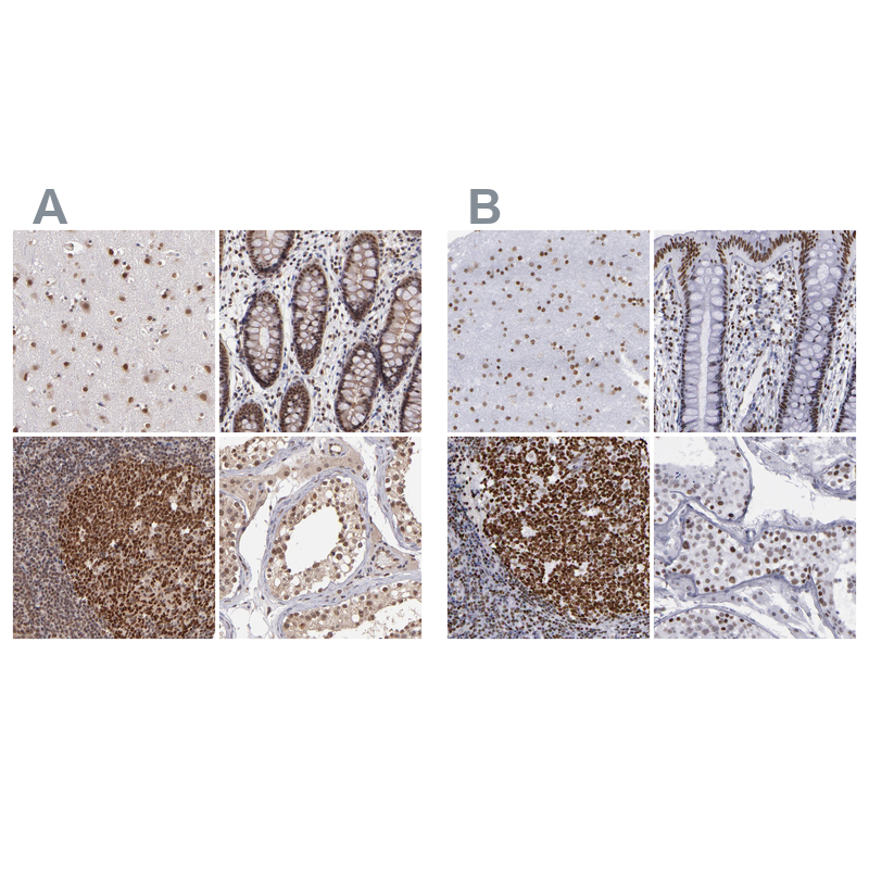 Atlas Antibodies Anti-TERF2 Antibody